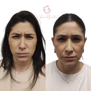 Harmonização facial no Cambuí